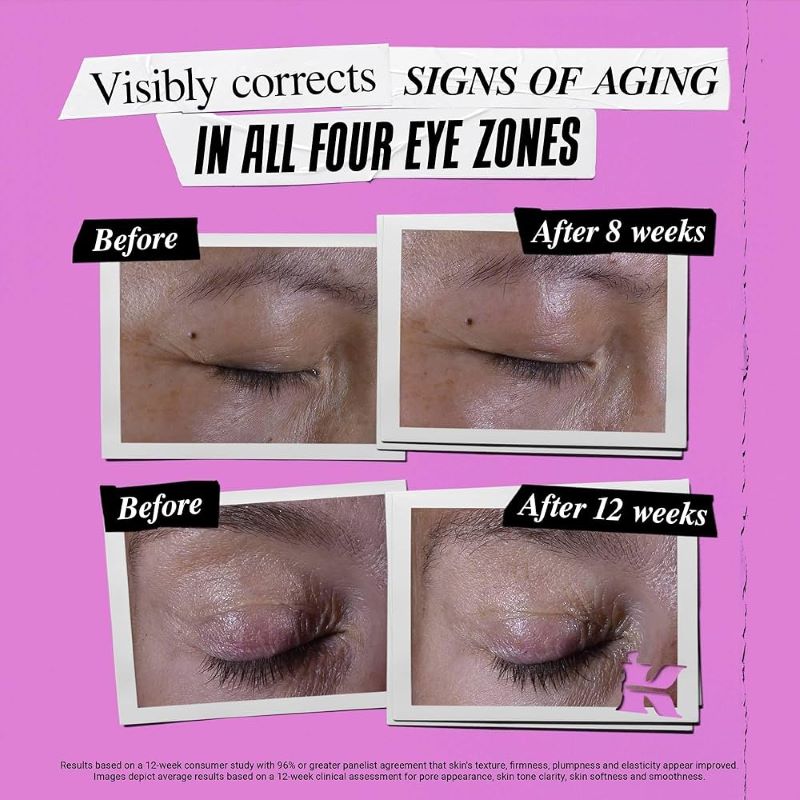 Kiehl's Super Multi-Corrective Eye Zone Treatment 3ml , ครีมบำรุงผิวรอบดวงตา Kiehl's  , อายครีม Kiehl's , ซื้อ KIEHL'S Super Multi-Corrective Eye Zone Treatment ,  Kiehl's Eye Cream , Kiehl's Eye Cream ราคา , Kiehl's Eye Cream รีวิว